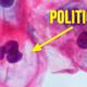 Illustration for article titled The Sex-Hating Hysteria Behind Republicans HPV Vaccine Debate